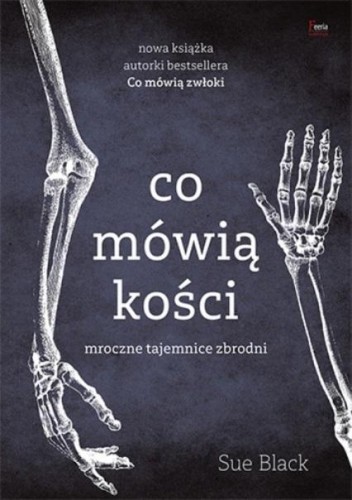 Co mówią kości w.2022, Sue Black